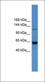 Anti-HDAC6 antibody produced in rabbit affinity isolated antibody