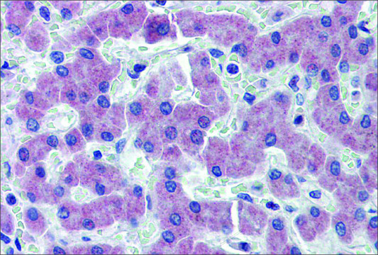 Anti-SLC27A2 antibody produced in rabbit affinity isolated antibody