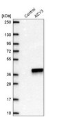 Anti-ACY3 antibody produced in rabbit Prestige Antibodies® Powered by Atlas Antibodies, affinity isolated antibody, buffered aqueous glycerol solution