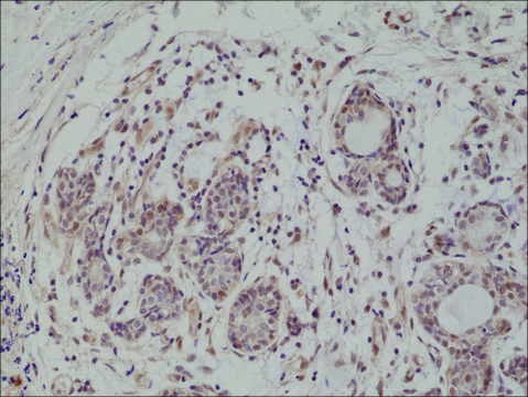 Anti-AKT (PH domain) antibody, Rabbit monoclonal recombinant, expressed in HEK 293 cells, clone RM316, purified immunoglobulin