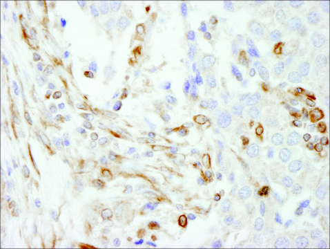 Rabbit anti-Vimentin Antibody, Affinity Purified Powered by Bethyl Laboratories, Inc.