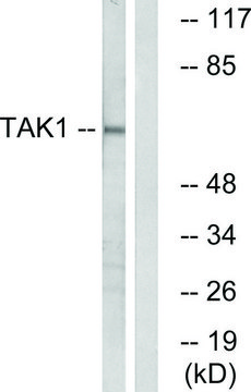 Anti-TAK1 antibody produced in rabbit affinity isolated antibody