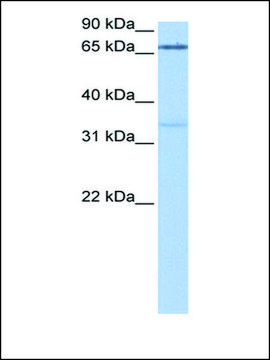 Anti-PADI2 antibody produced in rabbit affinity isolated antibody