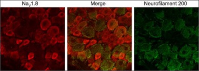 Anti-Sodium Channel NaV1.8 antibody produced in rabbit affinity isolated antibody, lyophilized powder