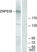 Anti-ZNF638 antibody produced in rabbit affinity isolated antibody