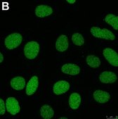 Anti-ZEB1 Antibody, clone 5C20 ZooMAb® Rabbit Monoclonal recombinant, expressed in HEK 293 cells
