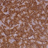 Anti-RPL13A antibody produced in rabbit Prestige Antibodies® Powered by Atlas Antibodies, affinity isolated antibody, buffered aqueous glycerol solution