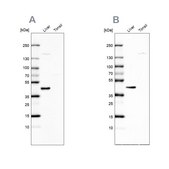 Anti-NADK2 antibody produced in rabbit Prestige Antibodies® Powered by Atlas Antibodies, affinity isolated antibody, buffered aqueous glycerol solution