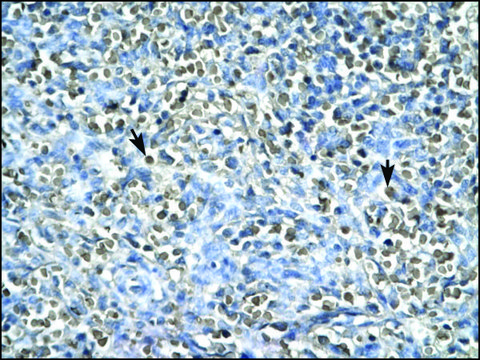 Anti-ASGR2 (AB2) antibody produced in rabbit IgG fraction of antiserum