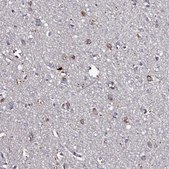 Anti-TK2 antibody produced in rabbit Prestige Antibodies® Powered by Atlas Antibodies, affinity isolated antibody, buffered aqueous glycerol solution