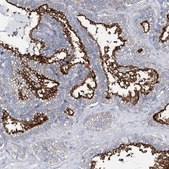 Anti-ANO1 antibody produced in rabbit Prestige Antibodies® Powered by Atlas Antibodies, affinity isolated antibody, buffered aqueous glycerol solution