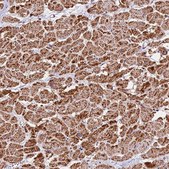 Anti-NDUFA8 antibody produced in rabbit Prestige Antibodies® Powered by Atlas Antibodies, affinity isolated antibody, buffered aqueous glycerol solution