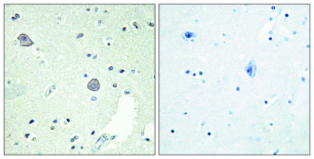 抗-DRD1 兔抗 affinity isolated antibody