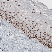 Monoclonal Anti-TLE3 antibody produced in mouse Prestige Antibodies® Powered by Atlas Antibodies, clone CL3573, purified immunoglobulin, buffered aqueous glycerol solution