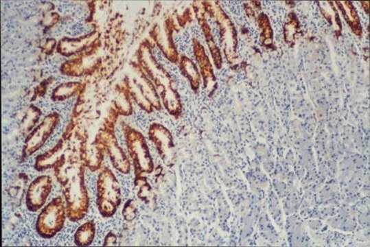 Anti-Mucin MUC5AC Antibody, clone CLH2 clone CLH2, Chemicon&#174;, from mouse