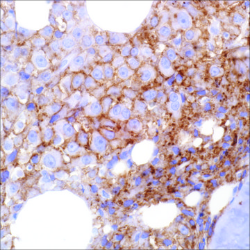 CD38 (SP149) Rabbit Monoclonal Antibody