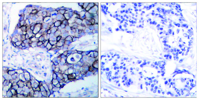 Anti-Integrin &#946;3 antibody produced in rabbit affinity isolated antibody