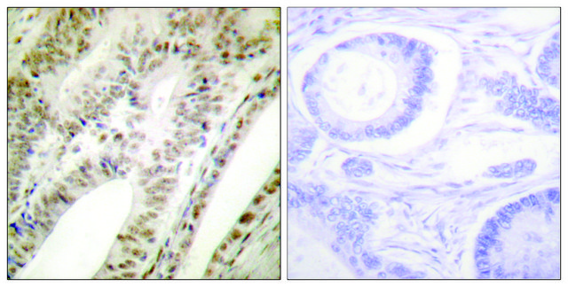 Anti-PML antibody produced in rabbit affinity isolated antibody