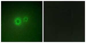 Anti-LRAT antibody produced in rabbit affinity isolated antibody