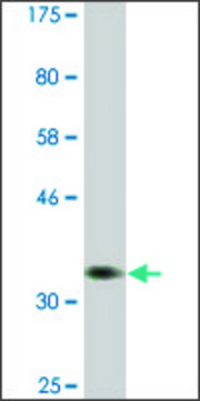 Monoclonal Anti-PSAT1, (C-terminal) antibody produced in mouse clone 1C2, ascites fluid