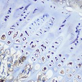 Anti-Aggrecan antibody produced in rabbit