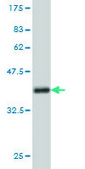 Monoclonal Anti-NVL antibody produced in mouse clone 3F6, purified immunoglobulin, buffered aqueous solution