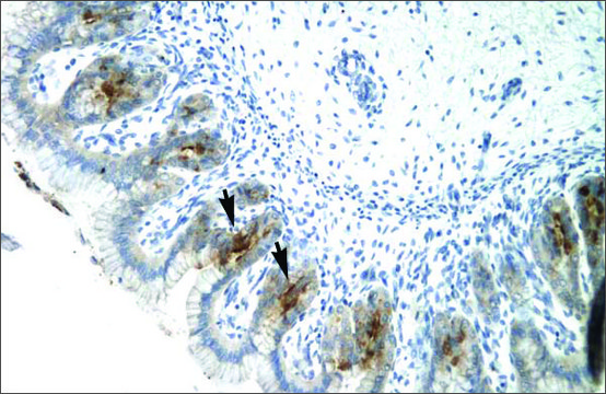 Anti-ETV6 antibody produced in rabbit affinity isolated antibody