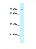 Anti-CTPS (AB1) antibody produced in rabbit IgG fraction of antiserum