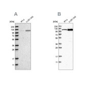 Anti-AASS antibody produced in rabbit Prestige Antibodies® Powered by Atlas Antibodies, affinity isolated antibody, buffered aqueous glycerol solution, Ab1