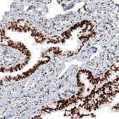 Monoclonal Anti-H2AFY2 antibody produced in mouse Prestige Antibodies® Powered by Atlas Antibodies, clone CL5263, purified immunoglobulin, buffered aqueous glycerol solution
