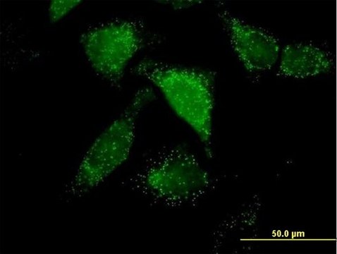 Anti-ACOX1 antibody produced in mouse purified immunoglobulin, buffered aqueous solution