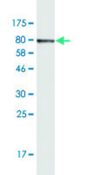 Monoclonal Anti-KRT6B antibody produced in mouse clone 3B6, purified immunoglobulin, buffered aqueous solution