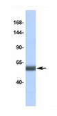 Anti-MLXIP antibody produced in rabbit affinity isolated antibody