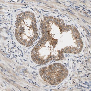 Anti-SEC23B antibody produced in rabbit Prestige Antibodies&#174; Powered by Atlas Antibodies, affinity isolated antibody, buffered aqueous glycerol solution