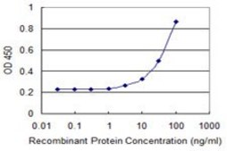 Monoclonal Anti-UBE2B antibody produced in mouse clone 1F11, purified immunoglobulin, buffered aqueous solution