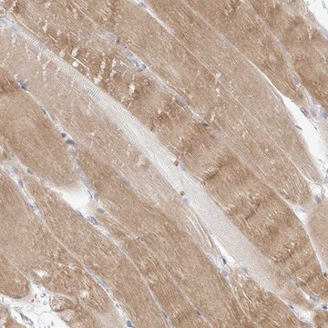 Anti-SLC2A12 antibody produced in rabbit Prestige Antibodies&#174; Powered by Atlas Antibodies, affinity isolated antibody, buffered aqueous glycerol solution