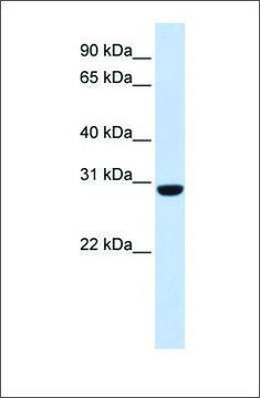 Anti-RCAN1 affinity isolated antibody