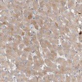 Anti-CFI antibody produced in rabbit Prestige Antibodies® Powered by Atlas Antibodies, affinity isolated antibody, buffered aqueous glycerol solution