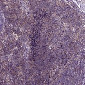 Anti-JAK3 antibody produced in rabbit Prestige Antibodies® Powered by Atlas Antibodies, affinity isolated antibody, buffered aqueous glycerol solution