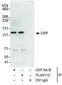Rabbit anti-CtIP Antibody, Affinity Purified Powered by Bethyl Laboratories, Inc.