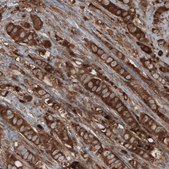 Monoclonal Anti-CARS antibody produced in mouse Prestige Antibodies® Powered by Atlas Antibodies, clone CL2310, purified immunoglobulin, buffered aqueous glycerol solution