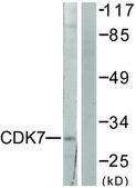 Anti-CDK7 antibody produced in rabbit affinity isolated antibody