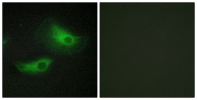 Anti-ADD2 antibody produced in rabbit affinity isolated antibody