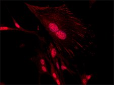Anti-Tensin 1 (C-terminal region) antibody produced in rabbit ~1.5 mg/mL, affinity isolated antibody