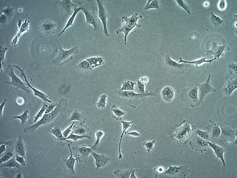 SK-MEL-37 Human Melanoma Cell Line