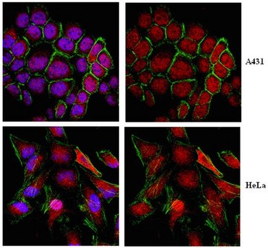 Anti-KEAP1 Antibody from rabbit, purified by affinity chromatography