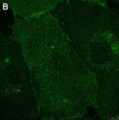 Anti-Integrin αVβ3 Antibody, clone LM609 ZooMAb® Mouse Monoclonal recombinant, expressed in HEK 293 cells