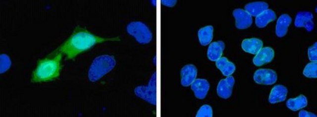 Anti-Histidine Tagged Antibody, clone 4D11, Alexa Fluor&#8482; 488 conjugate clone 4D11, Upstate&#174;, from mouse