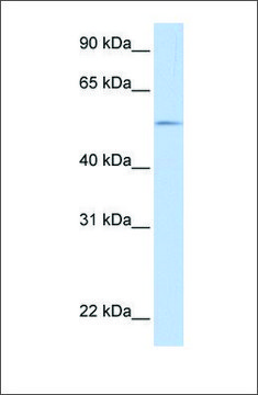 Anti-UGT1A1 affinity isolated antibody