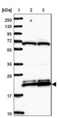 Anti-RPL17 antibody produced in rabbit Prestige Antibodies® Powered by Atlas Antibodies, affinity isolated antibody, buffered aqueous glycerol solution